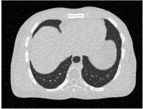 Augmented lagrangian iterative reconstruction method of X-ray image and CI image