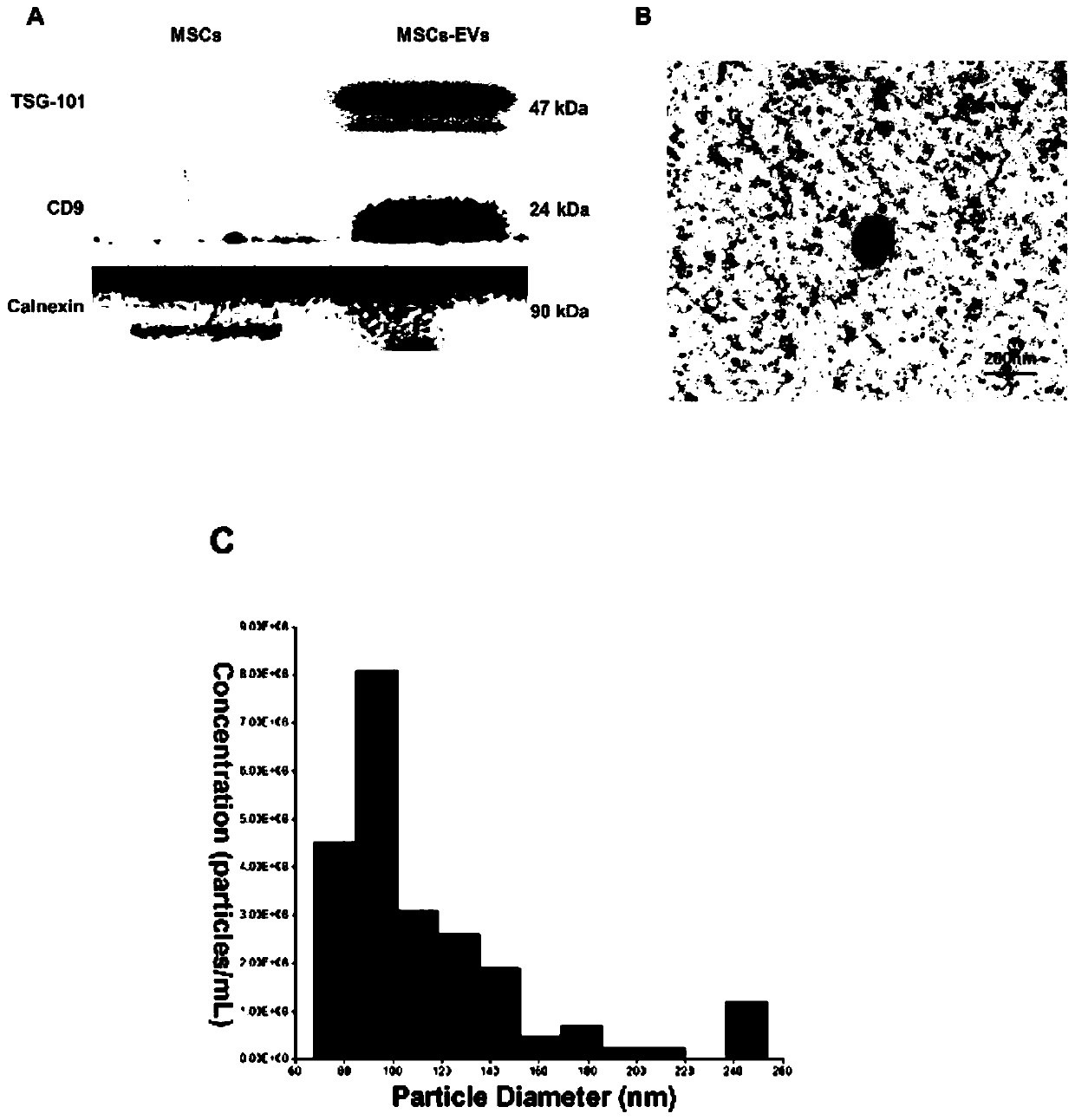 Application of extracellular vesicles derived from mesenchymal stem cells in treatment of subarachnoid hemorrhage