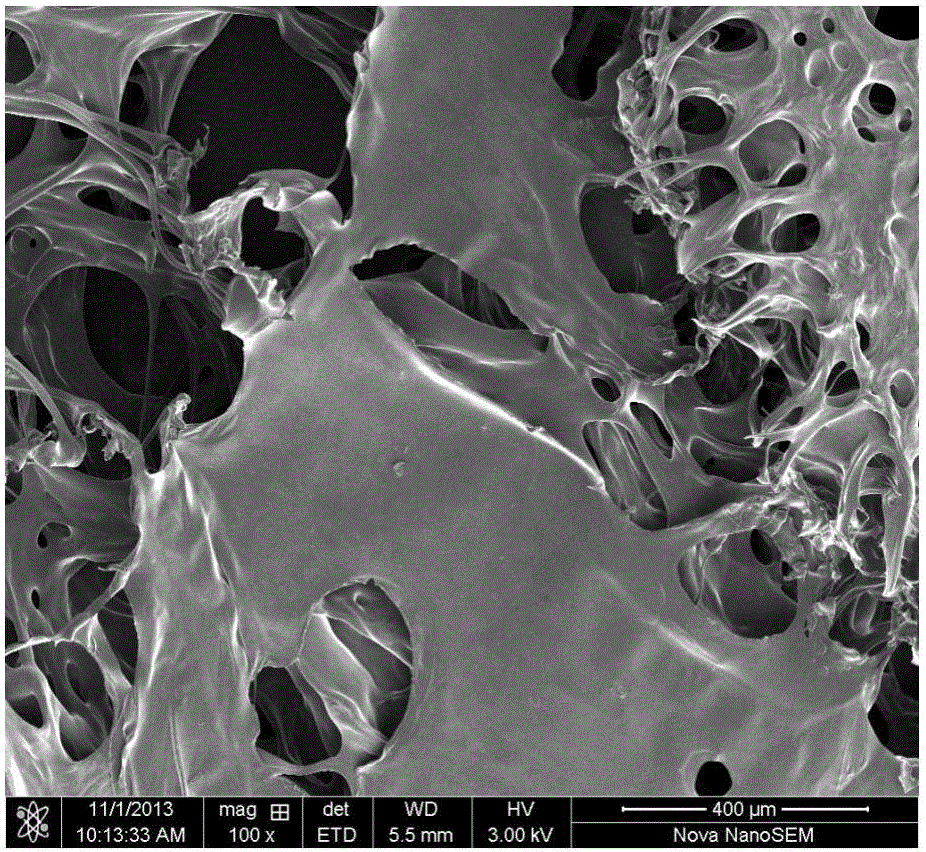 A kind of medical composite dressing and preparation method thereof