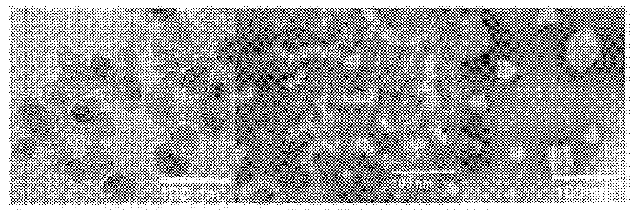 Use of a magnetic material in removal of stones