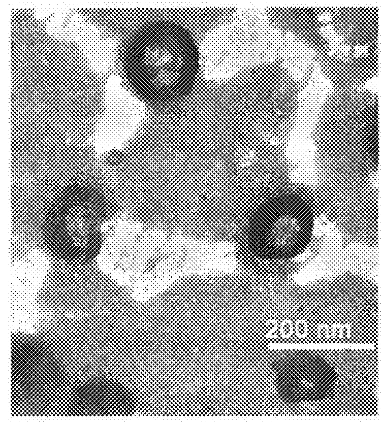 Use of a magnetic material in removal of stones