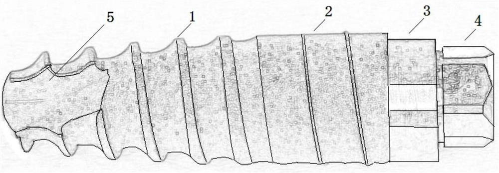 A zirconium-based amorphous metal glass dental implant and its preparation method