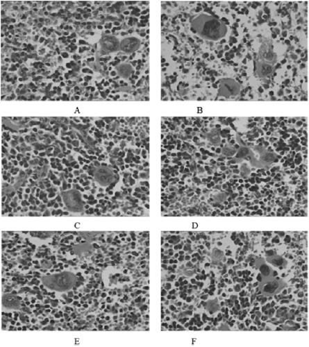 Yak skin polypeptide with blood tonifying effect and preparation method thereof