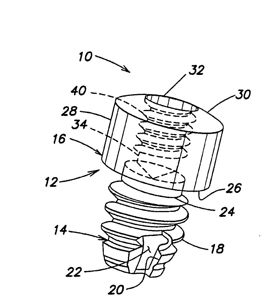 Dental implant for supporting a dental prosthesis