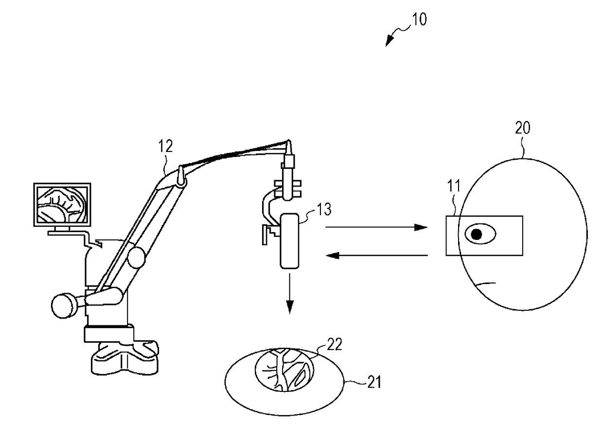 Surgical control device, control method, and imaging control system