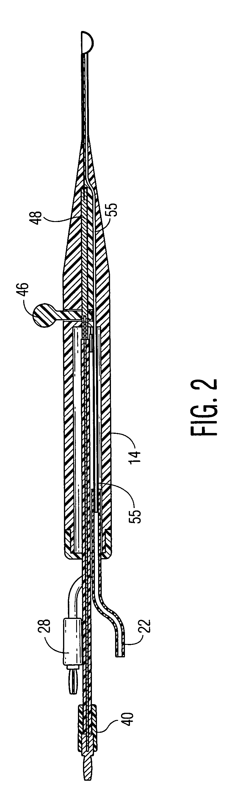 RF intervertebral electrosurgical probe