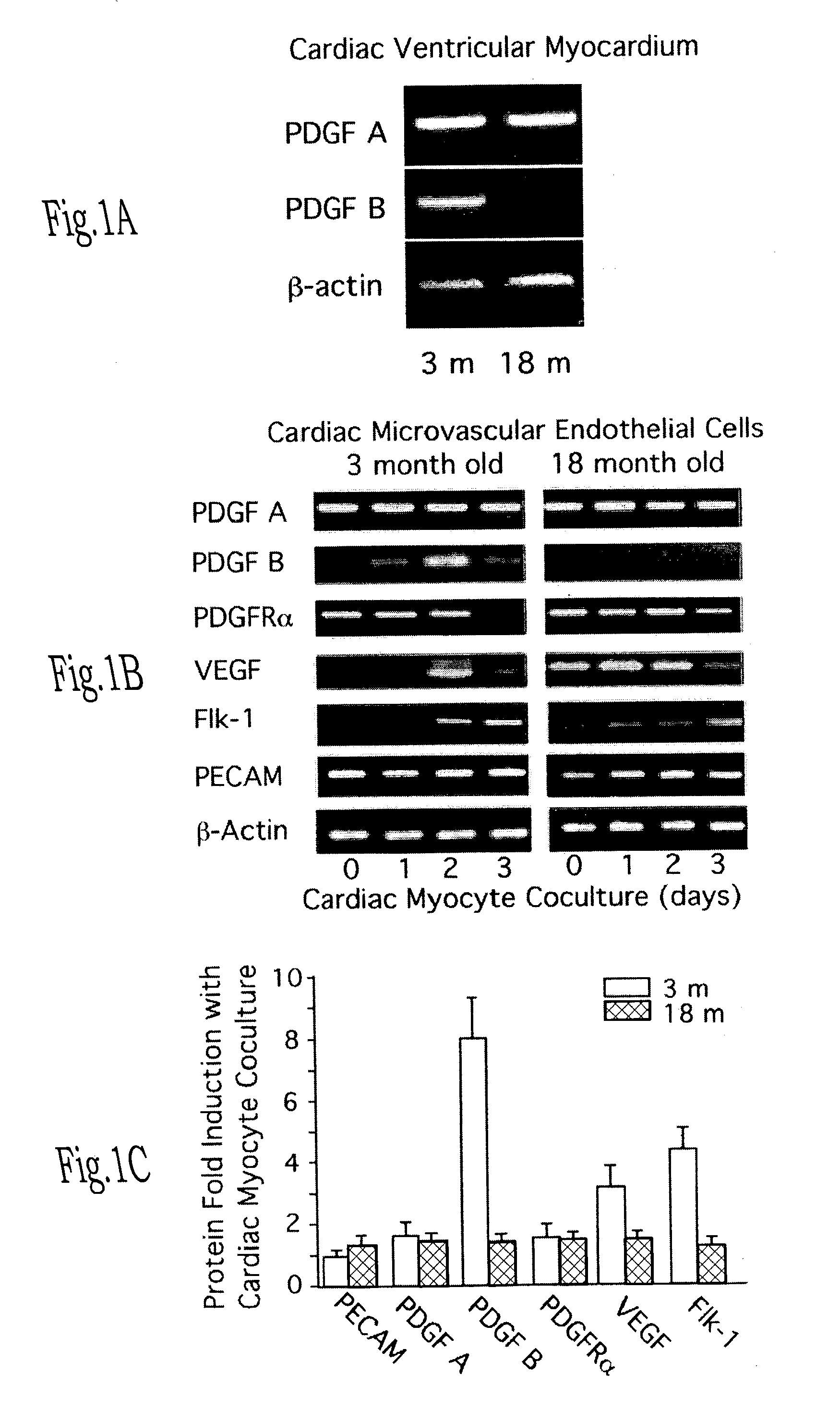 Endothelial precursor cells for enhancing and restoring vascular function