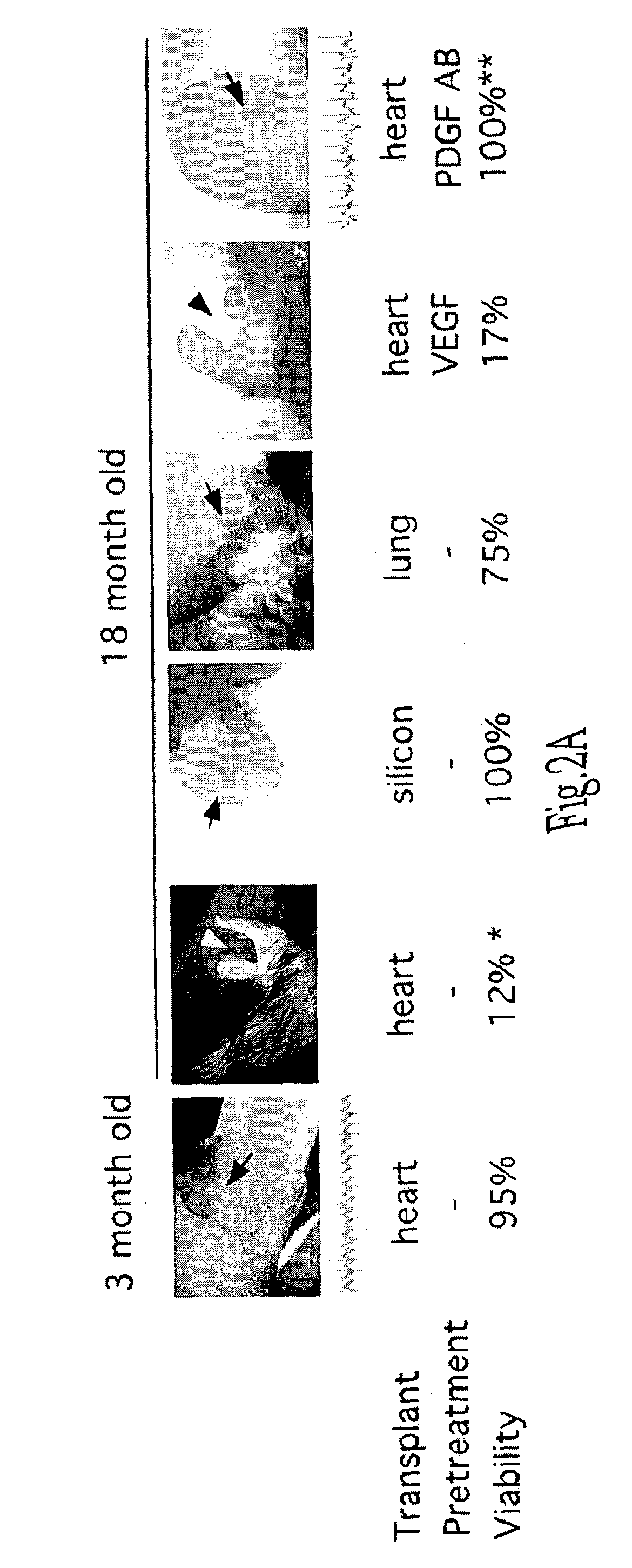 Endothelial precursor cells for enhancing and restoring vascular function