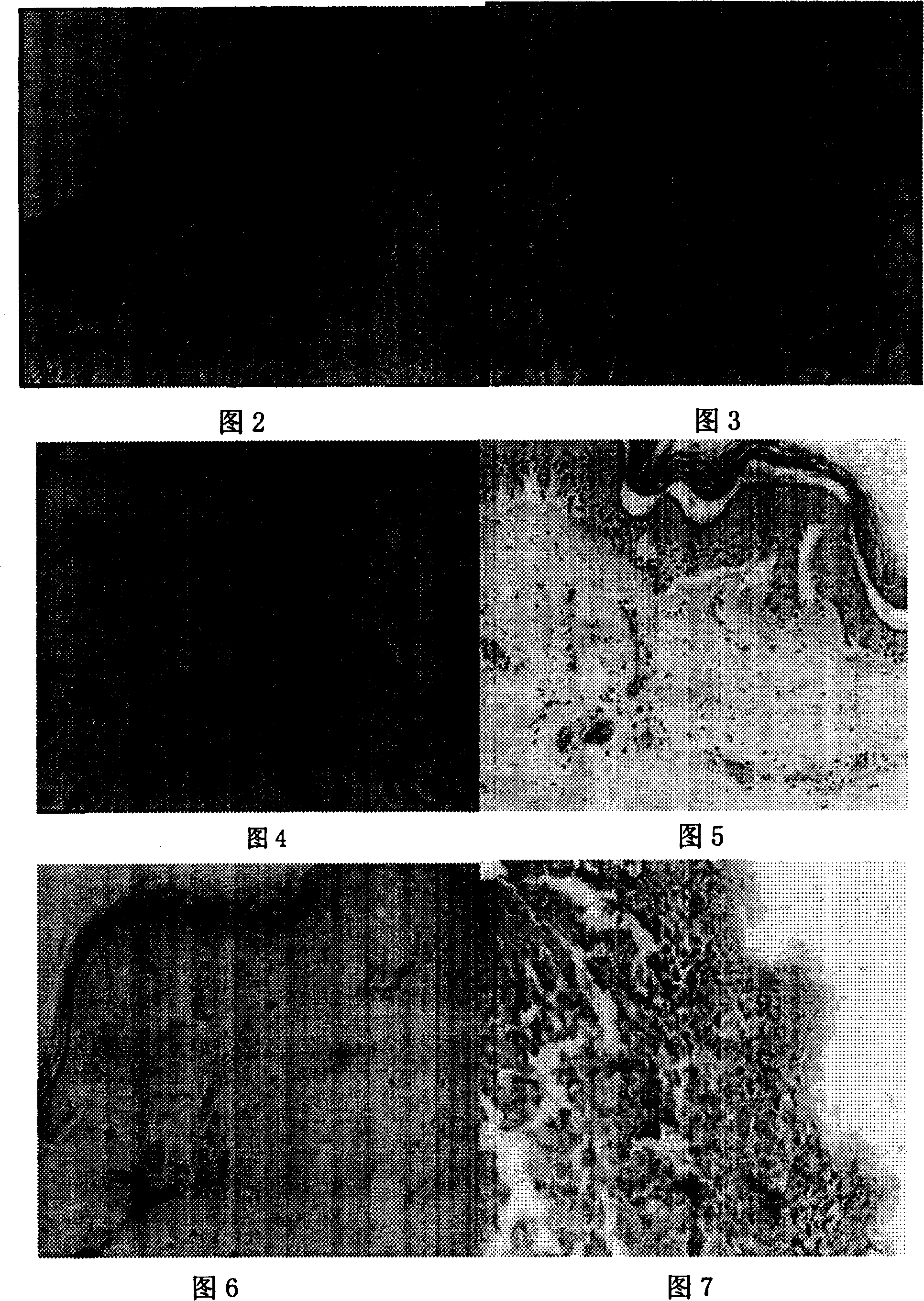 Medicinal composition for treating burn and its preparing method