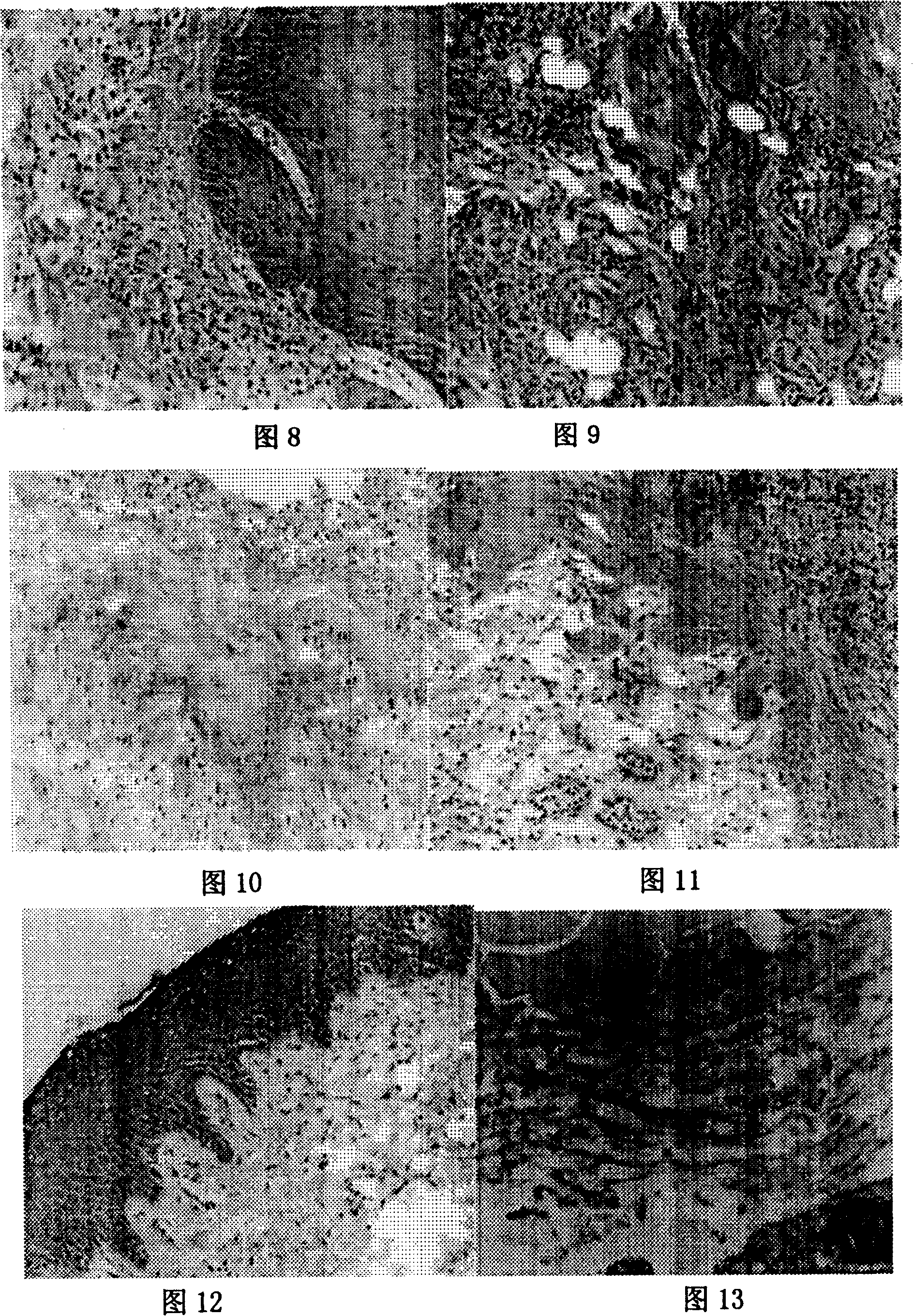 Medicinal composition for treating burn and its preparing method