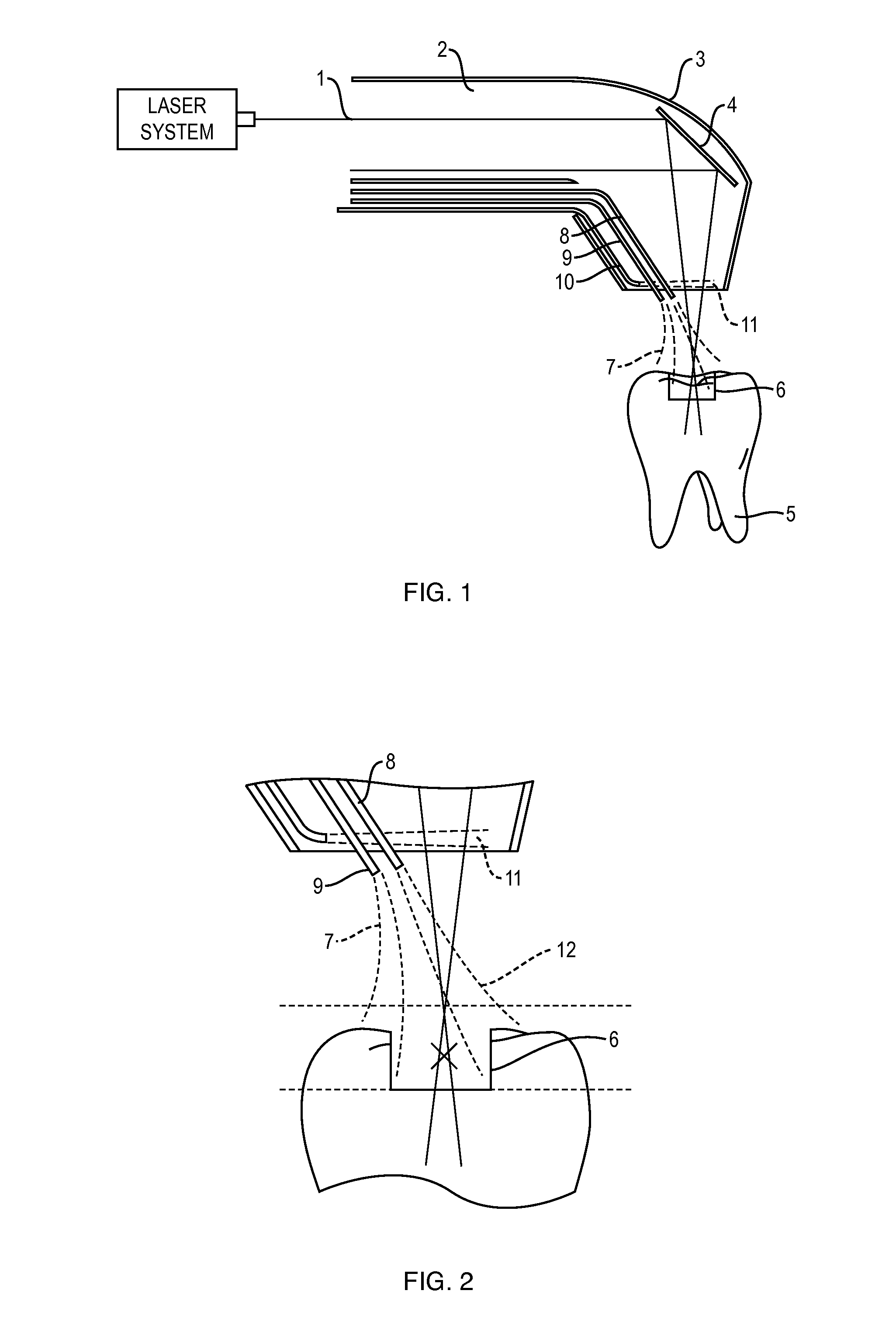 Apparatus and Method for Controlled Fluid Cooling During Laser Based Dental Treatments