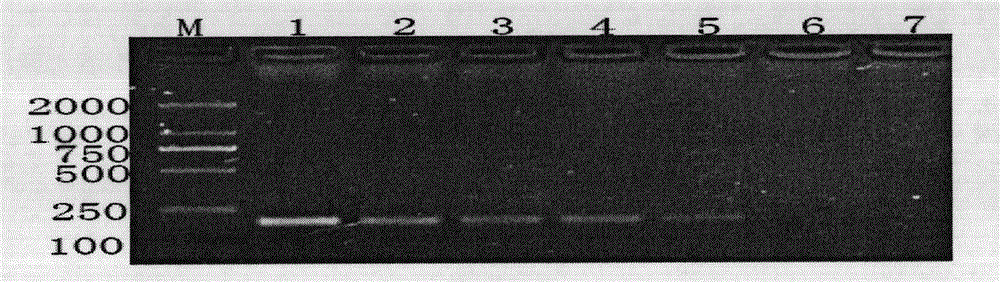 Specific PCR detection method of Riemerella anatipestifer