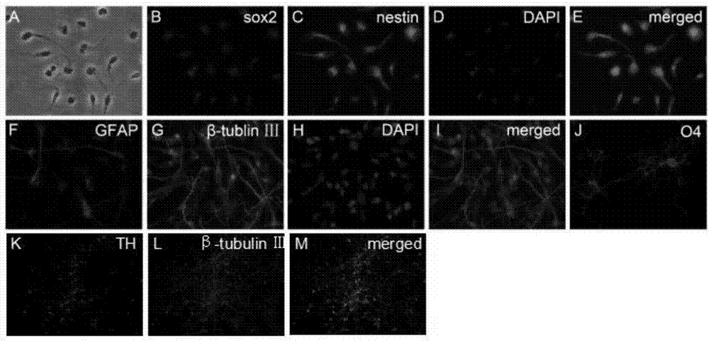 Neural stem cell preparation for treating Parkinson's disease through nasal delivery