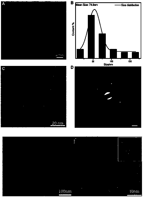 Medicine carrier based on nano diamond, medicinal complex as well as preparation method and application thereof