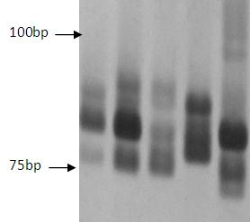 Method for discriminating Chinese milk vetch variety by using SSR (Simple Sequence Repeat)fingerprint spectrum