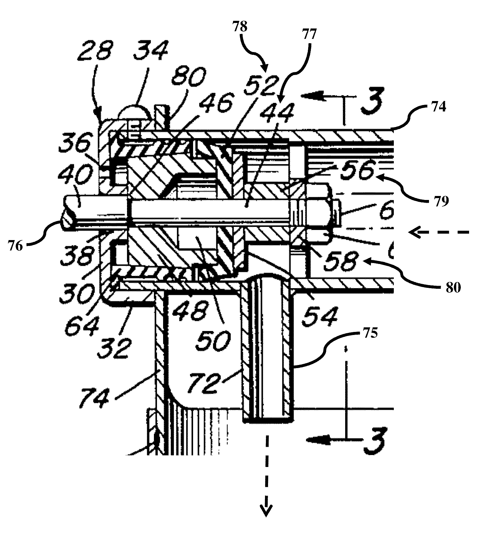 Siphon pump technology and apparatuses