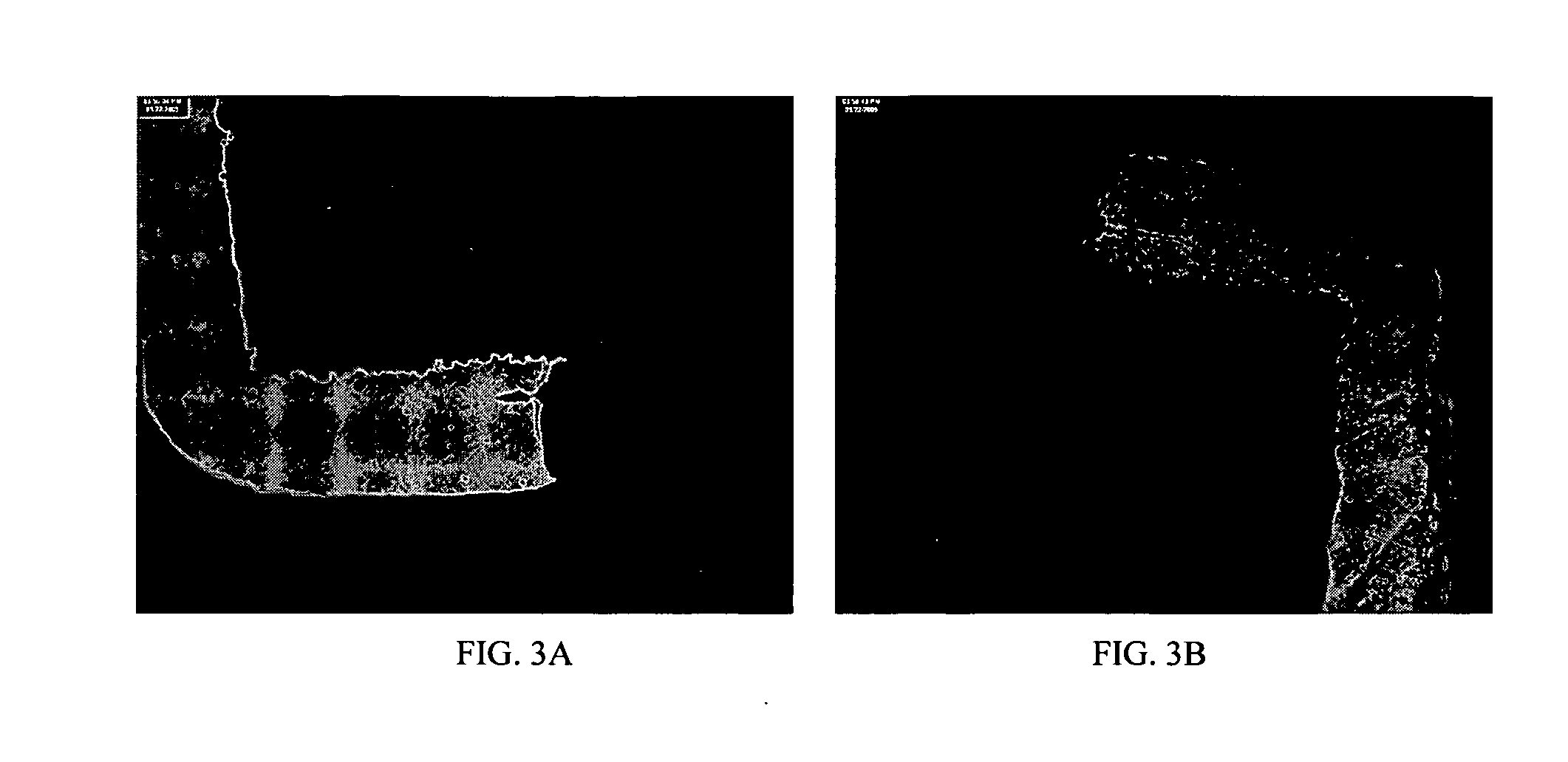 Method of using ultrasonics to plate silver