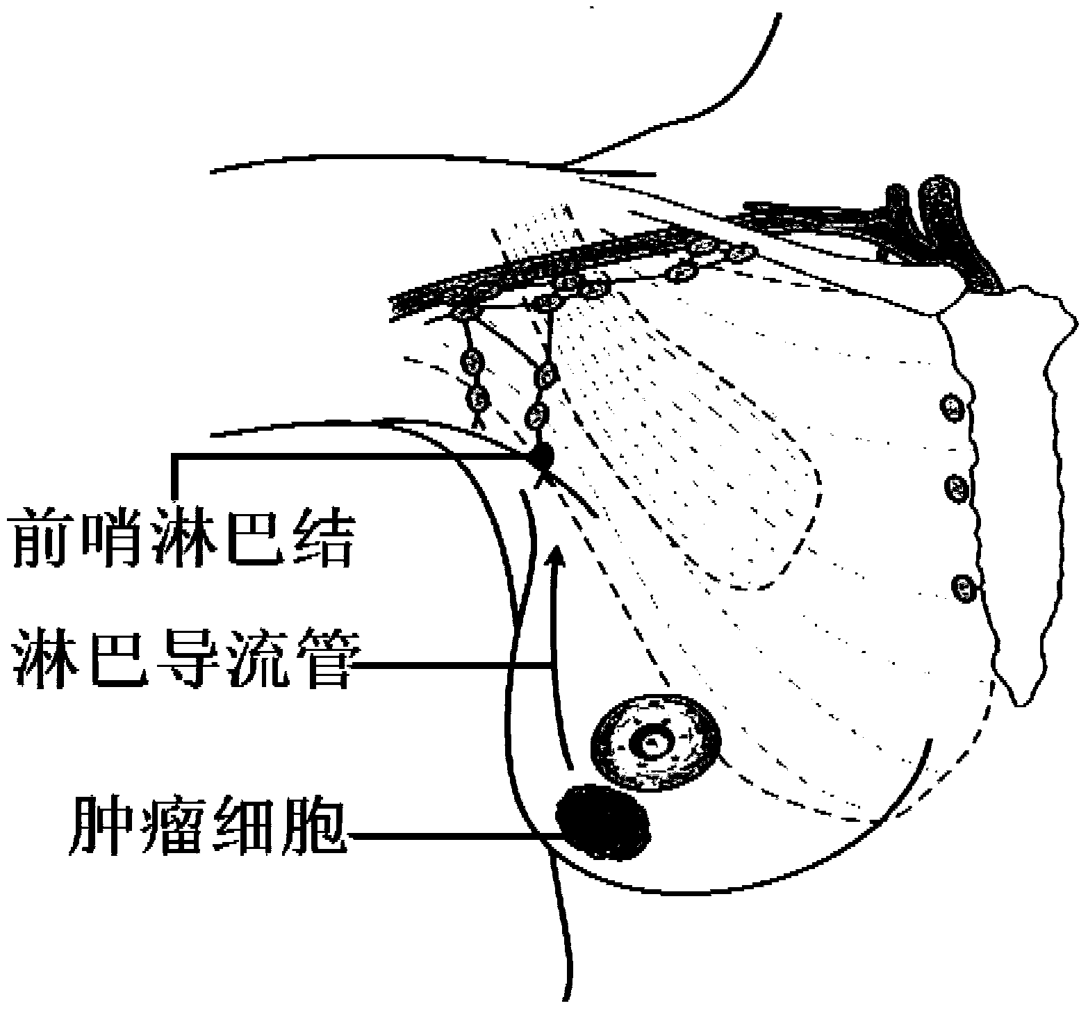 Primer set for intraoperatively and assistedly identifying whether sentinel node generates breast cancer cell metastasis, and application thereof