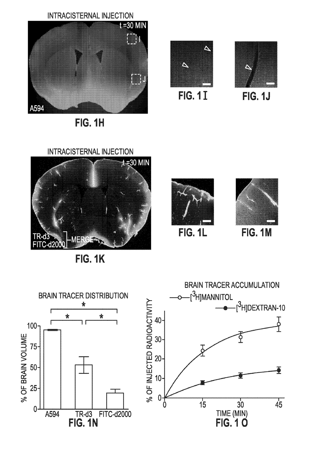 Methods for evaluating brain-wide paravascular pathway for waste clearance function and methods for treating neurodegenerative disorders based thereon