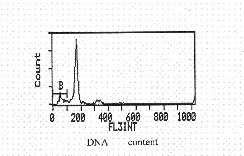 Medicine for treating coronary heart disease and preparation method thereof