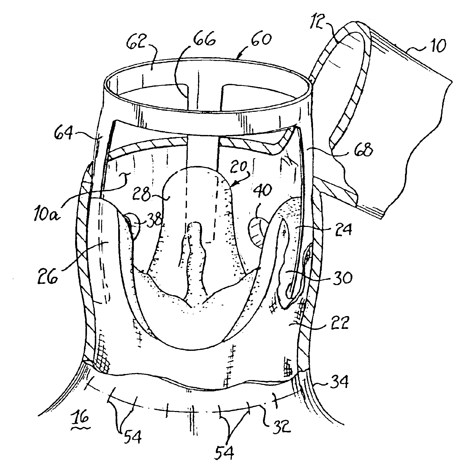 Heart valve and apparatus for replacement thereof