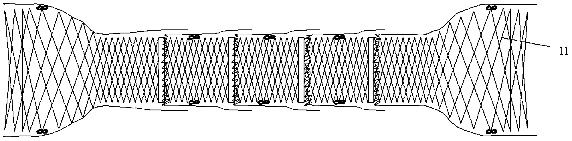 Degradable human body stent capable of effectively preventing transposition and reducing hyperplasia and manufacturing method