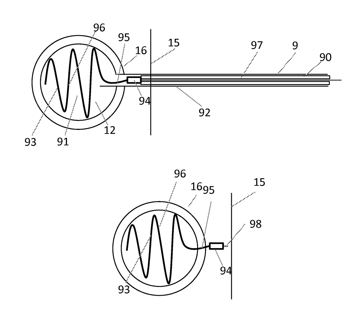 Systems and methods for implant delivery