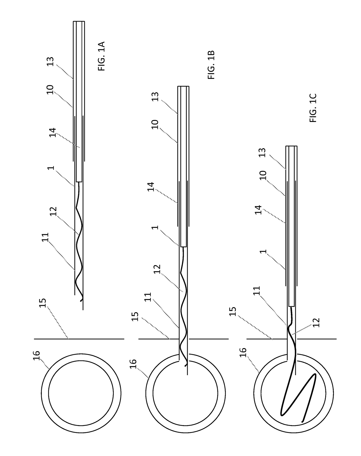 Systems and methods for implant delivery