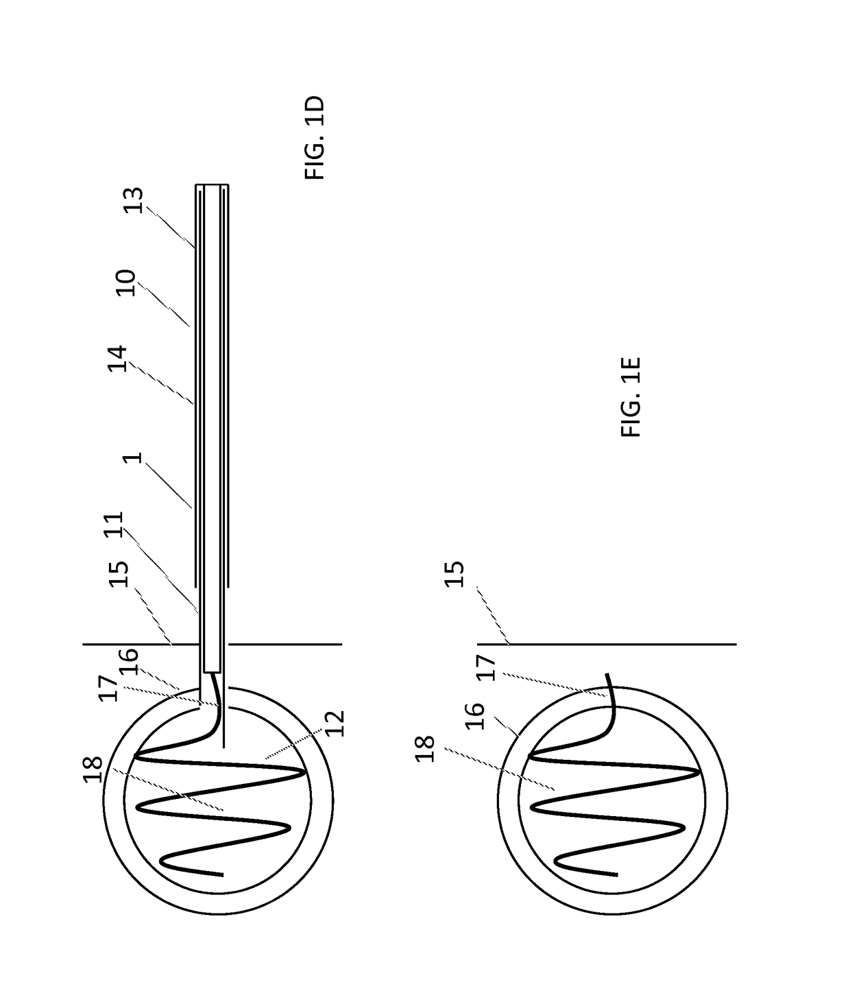 Systems and methods for implant delivery