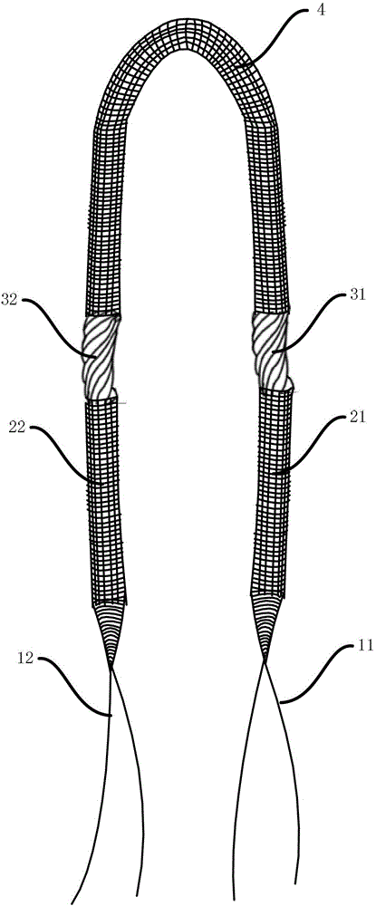 Foldable suspension-type artificial ligament