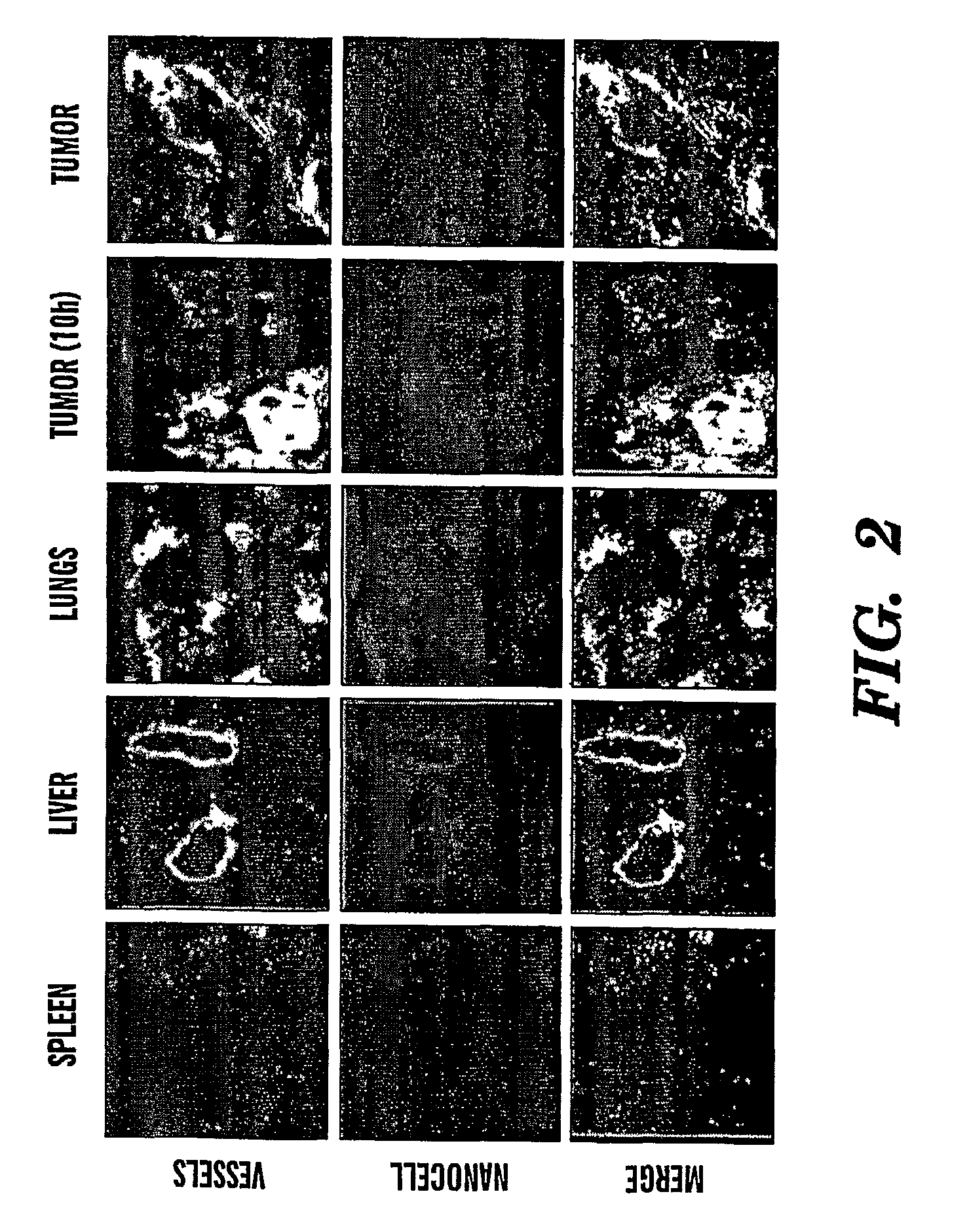 Nanocells for Diagnosis and Treatment of Diseases and Disorders