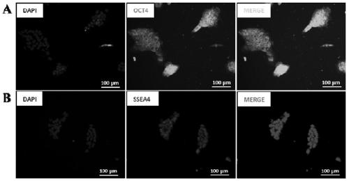 BTHS inducible multi-functional stem cells, preparation method thereof, differential culture medium and purpose