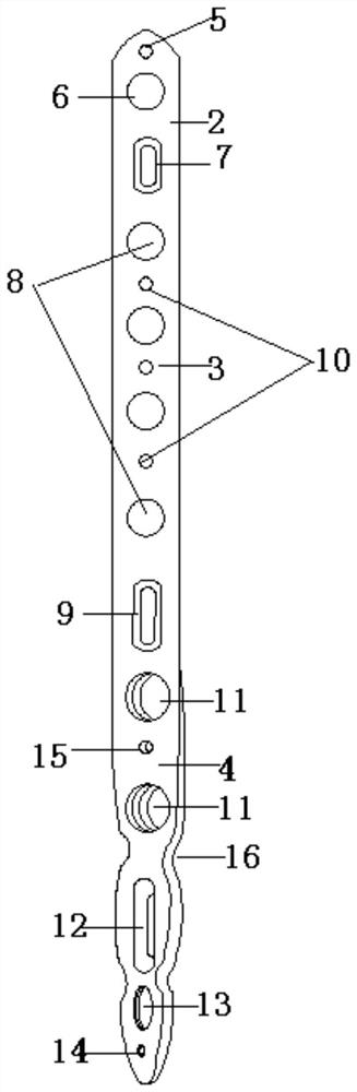 Humerus anterolateral bone fracture plate