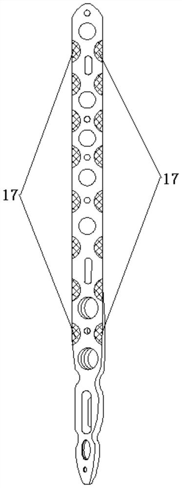 Humerus anterolateral bone fracture plate