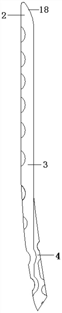 Humerus anterolateral bone fracture plate