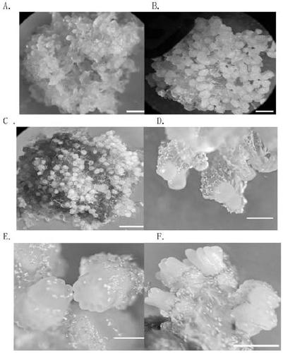 LarixLeptolepis somatic embryo regeneration method