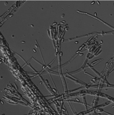 Mycoplasma pink, its solid fermentative inoculum and its application