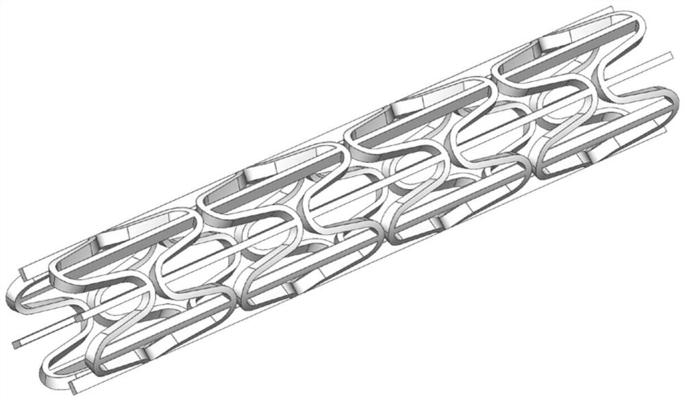 A Negative Poisson's Ratio Degradable Vascular Stent Structure