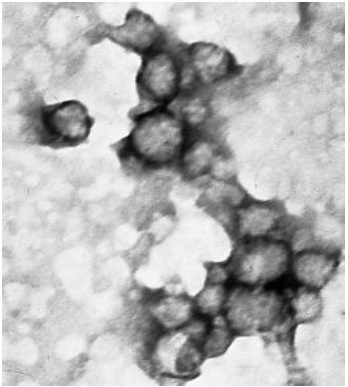 Application of ursolic-acid nano medicine-carrying microspheres for treating tumors and preparation