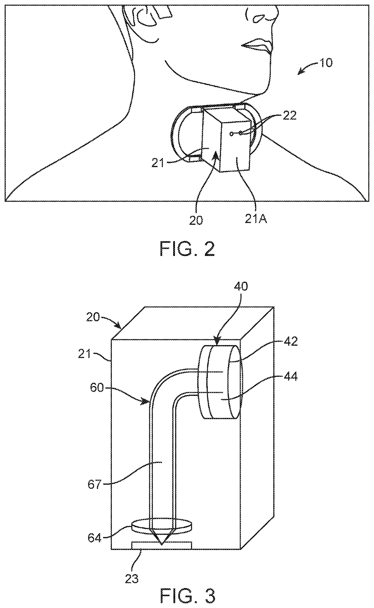 Automatic tracheotomy device