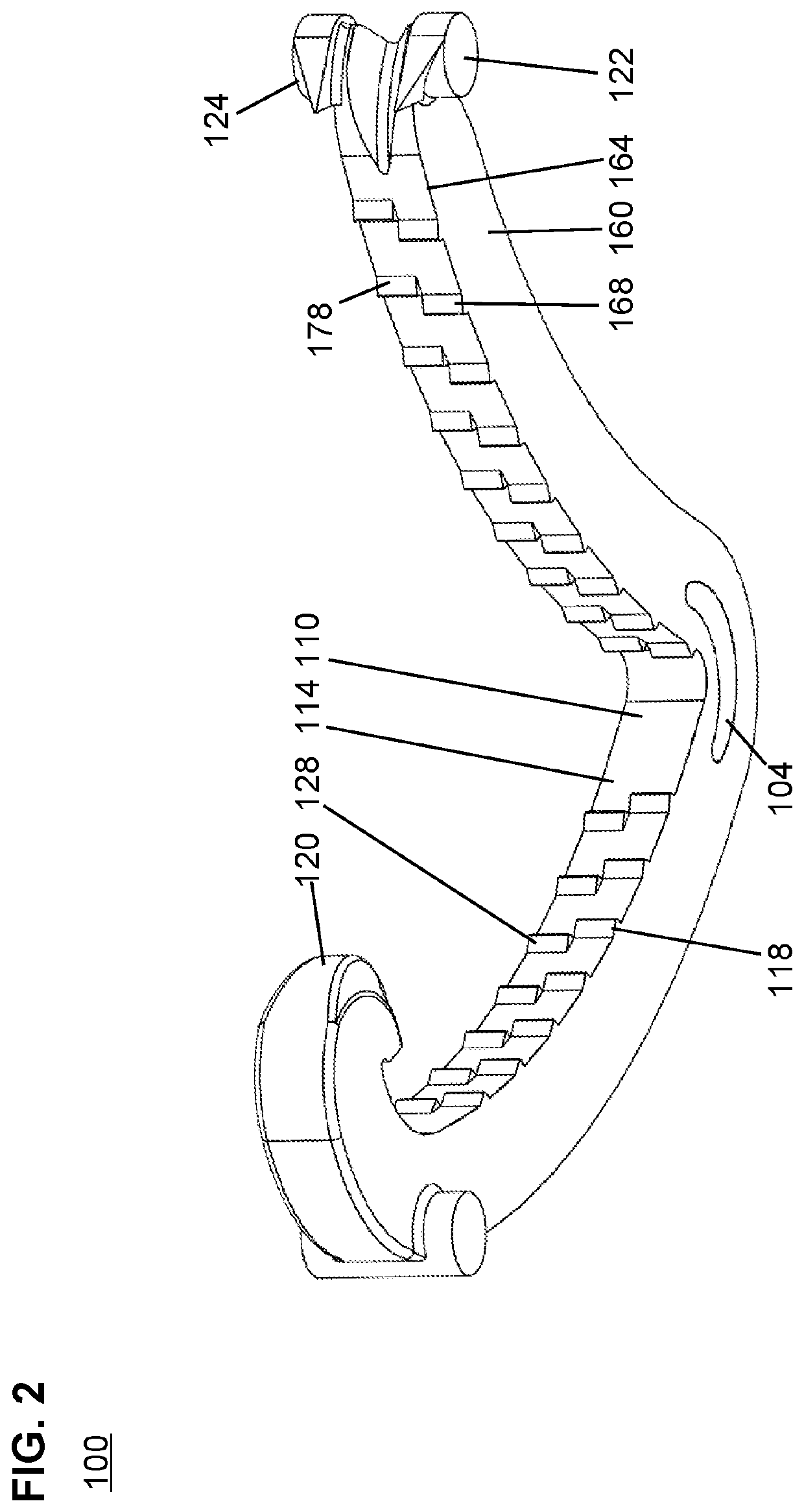 Ligation clips with anti-migration features