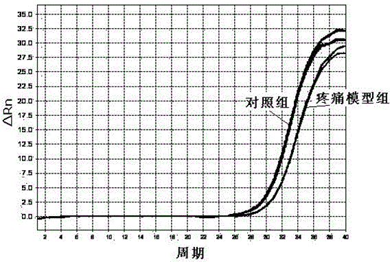 Application of miRNA-219 compound in the preparation of chronic pain diagnostic markers and therapeutic drugs