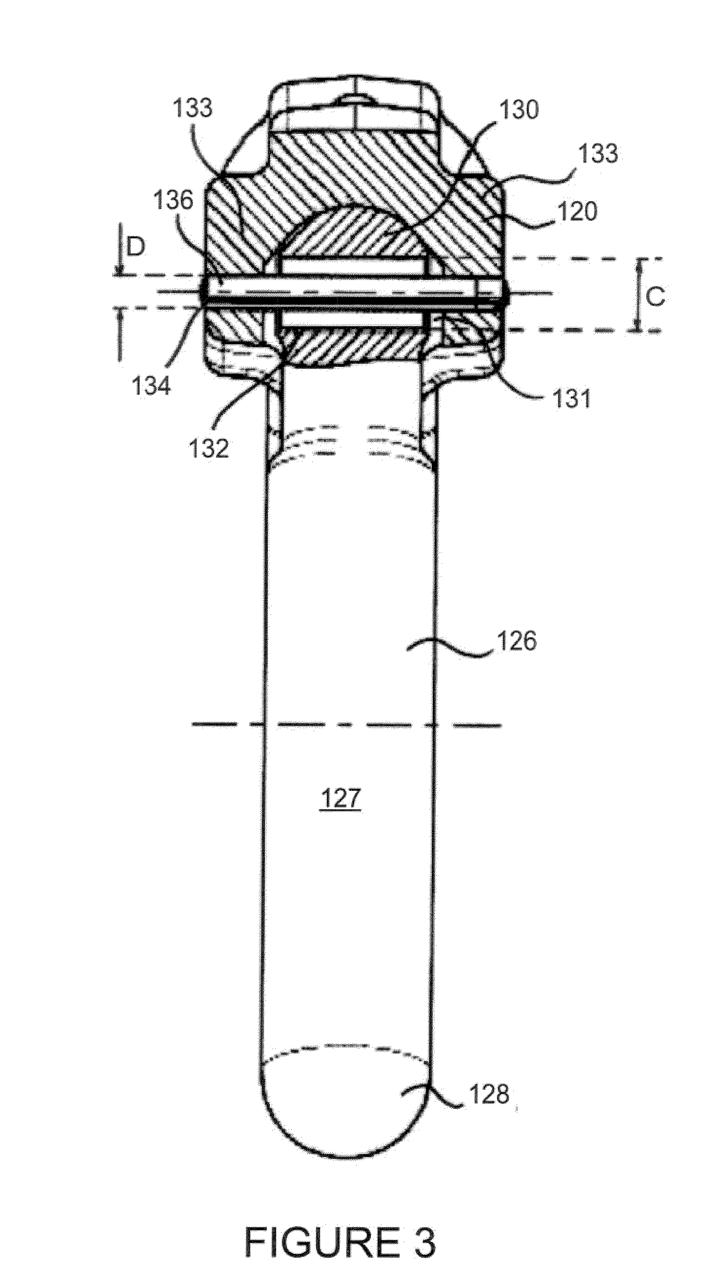 Retaining formation