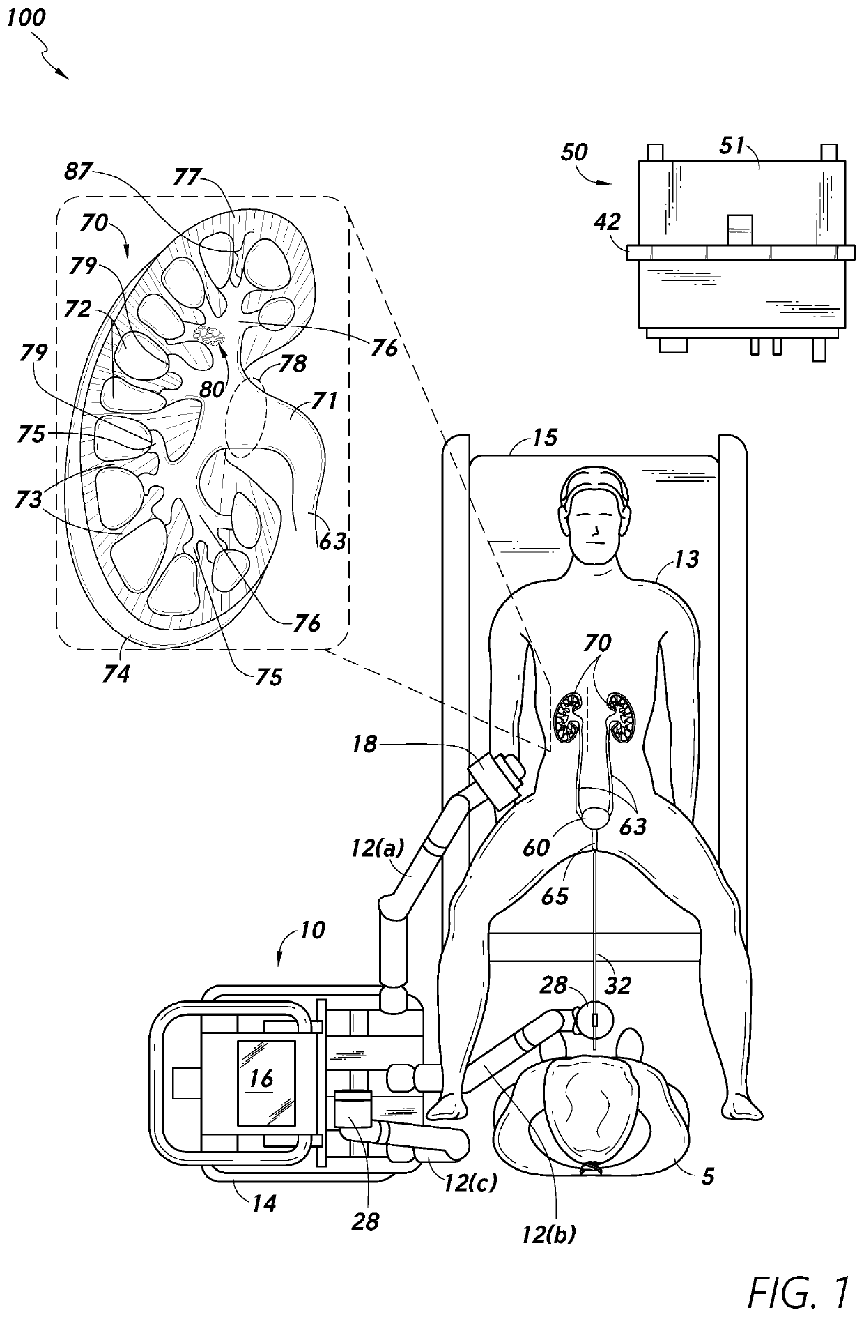 Target anatomical feature localization