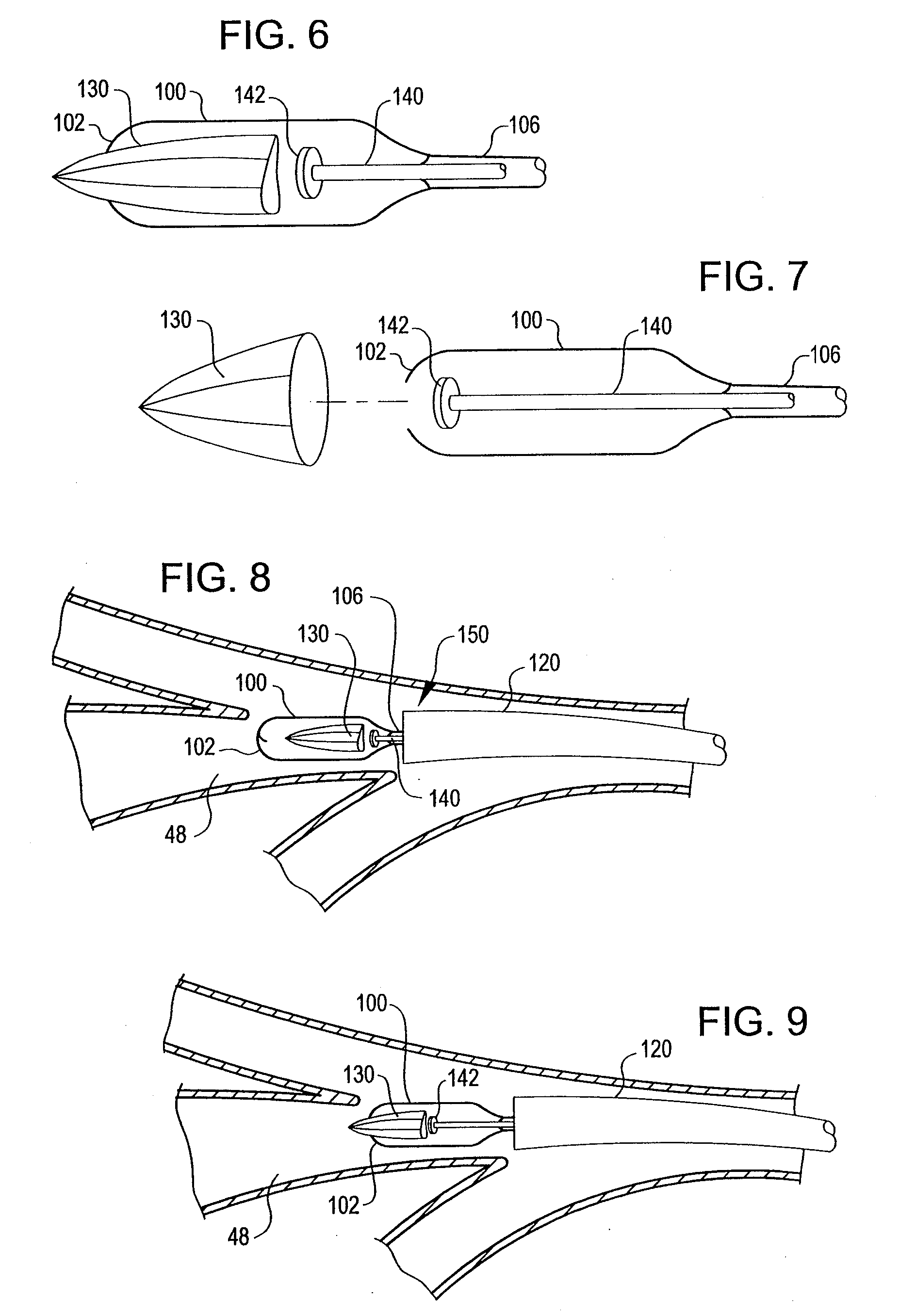 Apparatus and method for deployment of a bronchial obstruction device