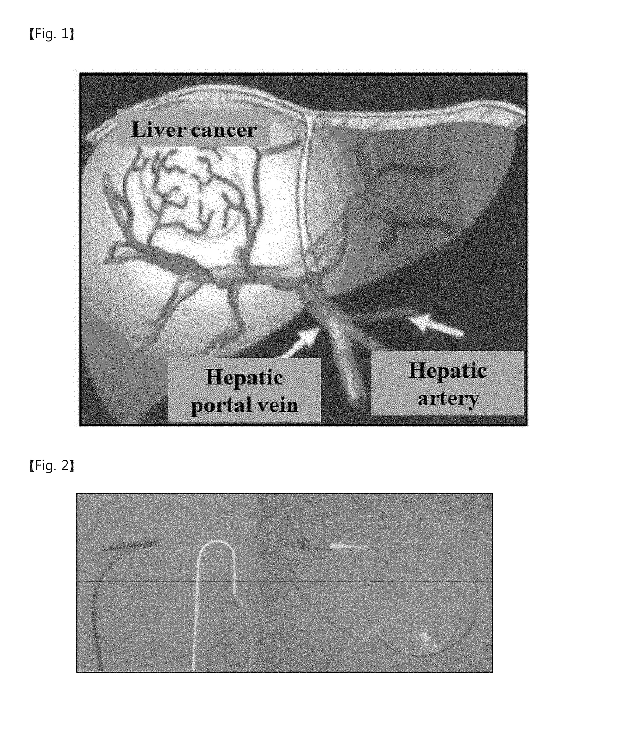 Vascular intervention robot and vascular intervention system