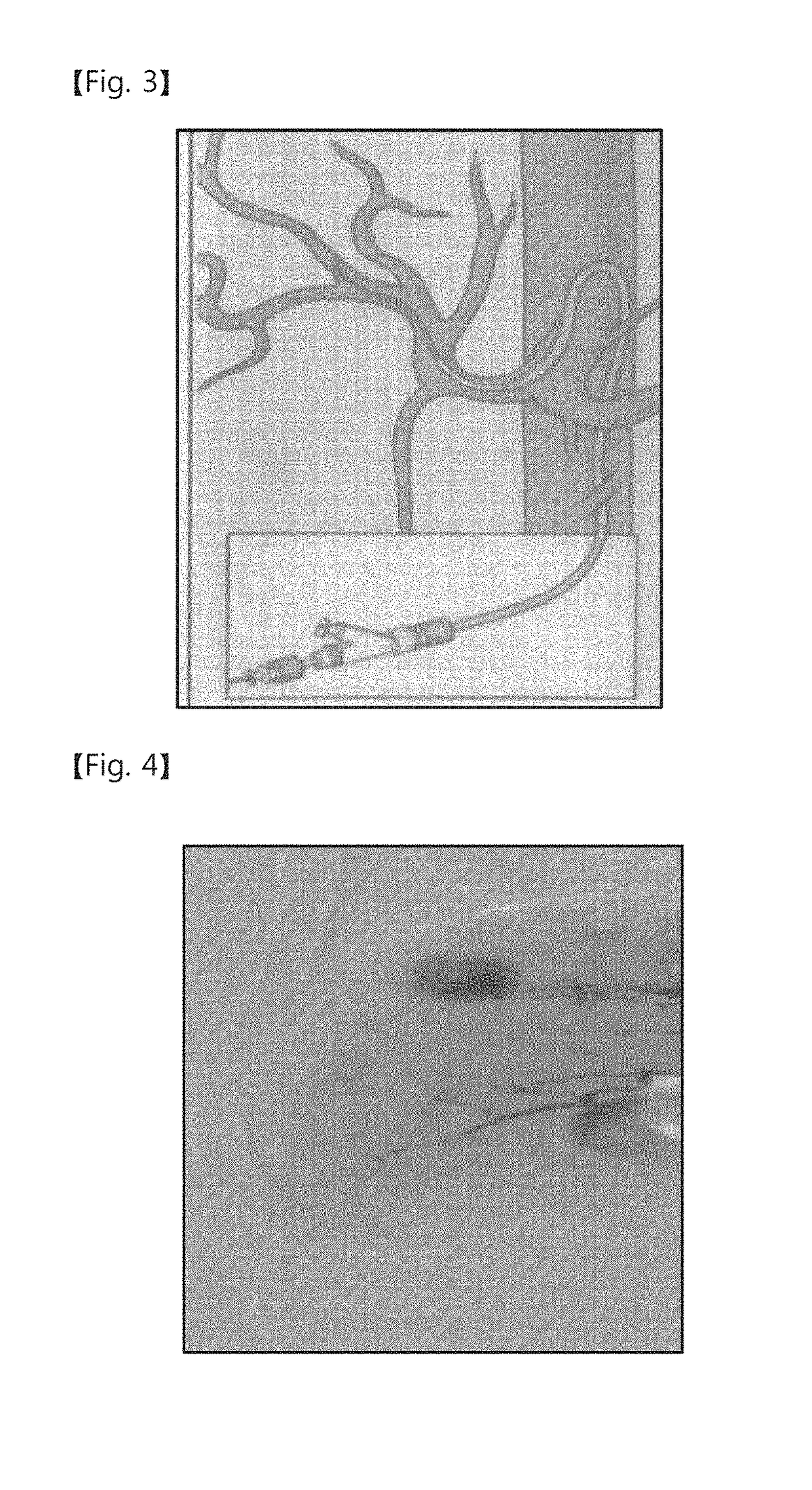 Vascular intervention robot and vascular intervention system