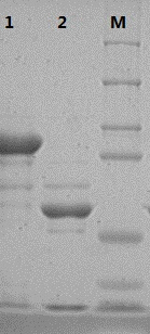 Type 31 recombinant human papillomavirus virus-like particle and its preparation method