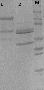 Type 31 recombinant human papillomavirus virus-like particle and its preparation method