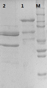 Type 31 recombinant human papillomavirus virus-like particle and its preparation method